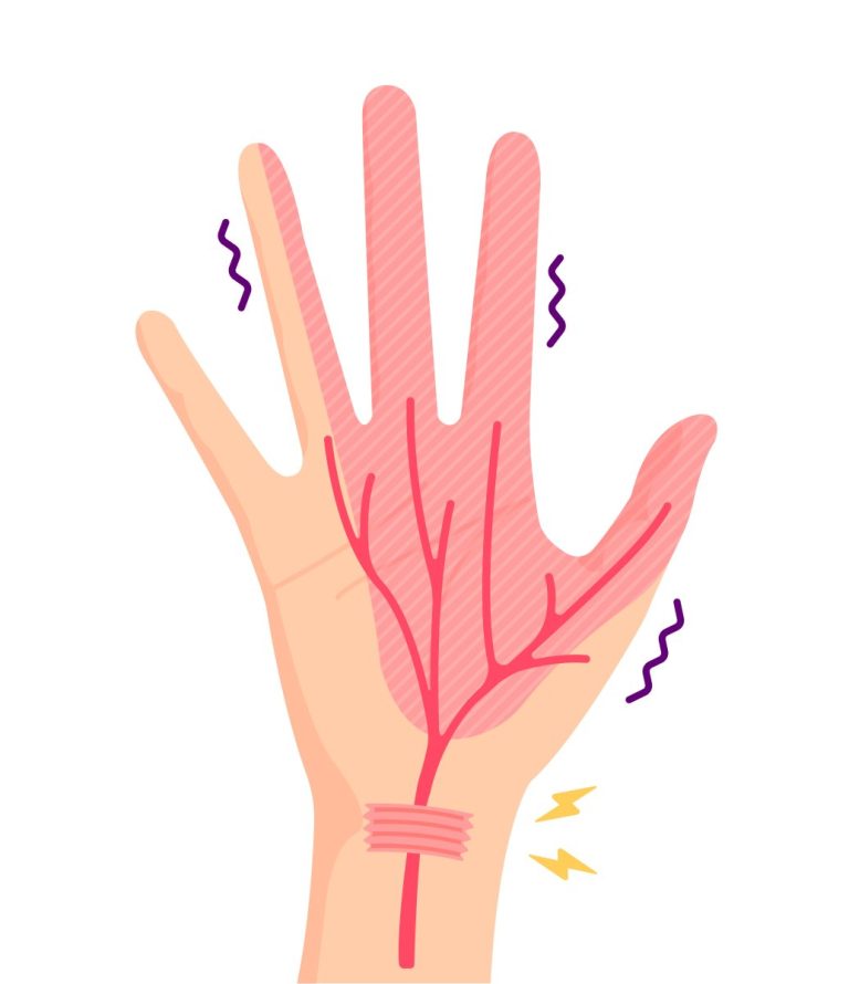 Diagnostyka EMG/ENeG nadgarstka